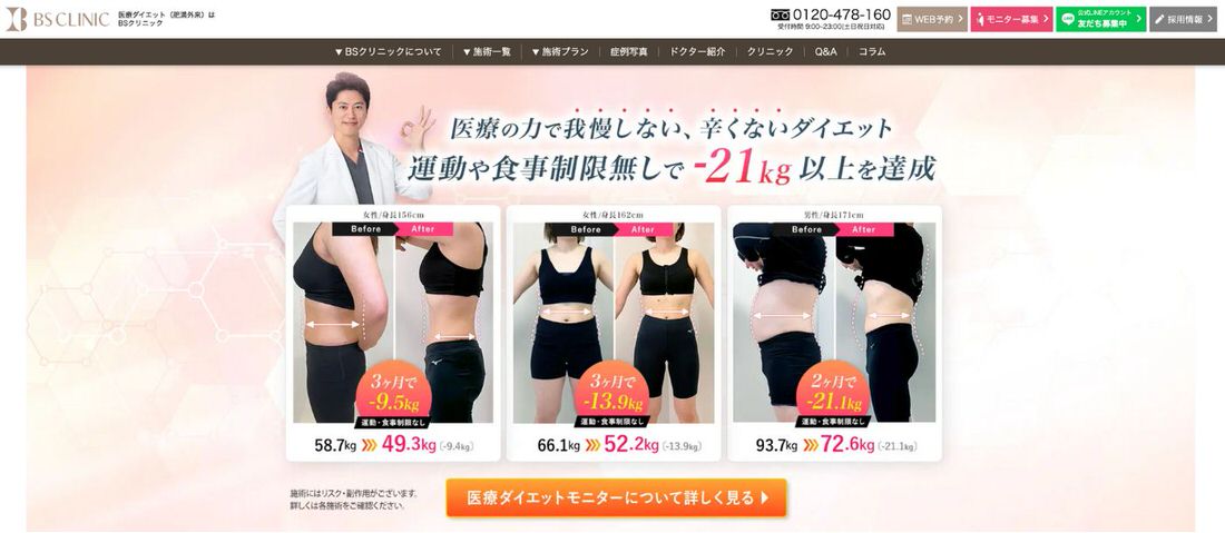 diet monitor22 無料・格安でダイエットモニターを募集しているクリニック【4選】注意点も